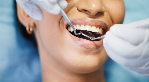 Best Emergency Dentist for Knocked-Out Tooth in Sloatsburg, NY